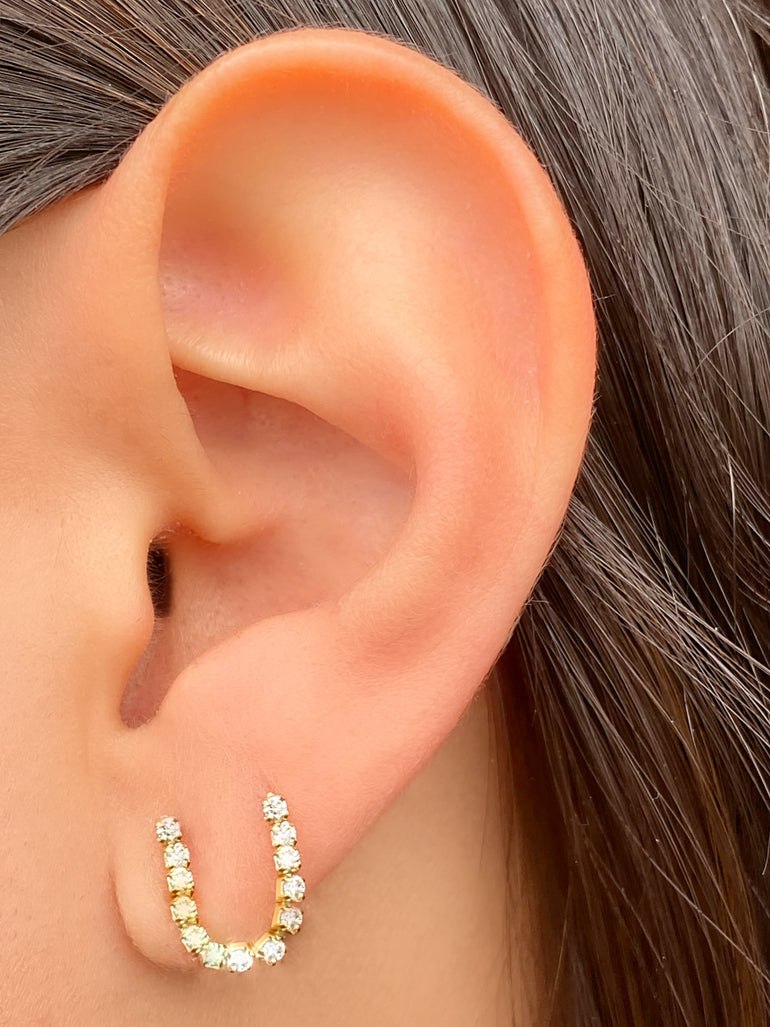 Arete Forma U Zirconias
