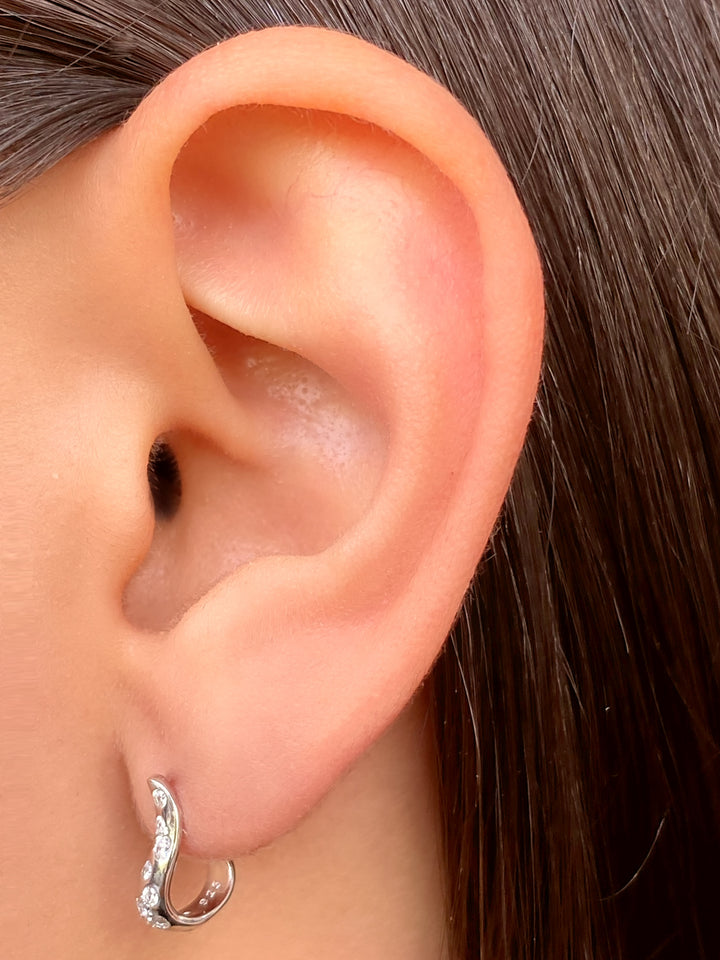 Par Arete Forma J Zirconias