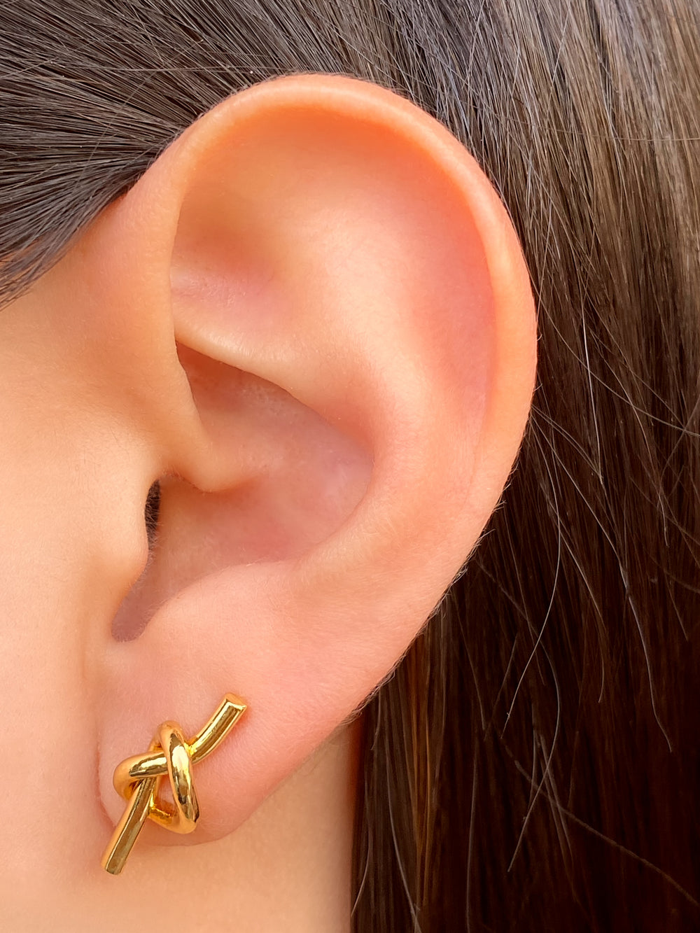 Par Arete Nudo