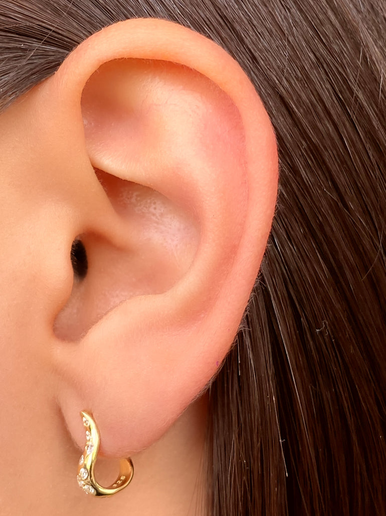 Par Arete Forma J Zirconias