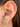Par Arete Clavo Zirconias
